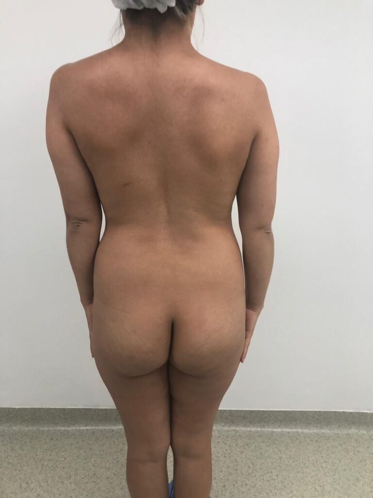 Colcirugia-ColaBBL-01