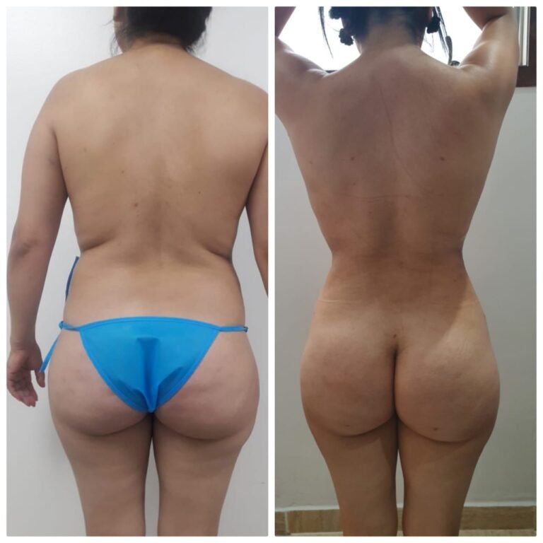 Colcirugia-ColaBBL-02