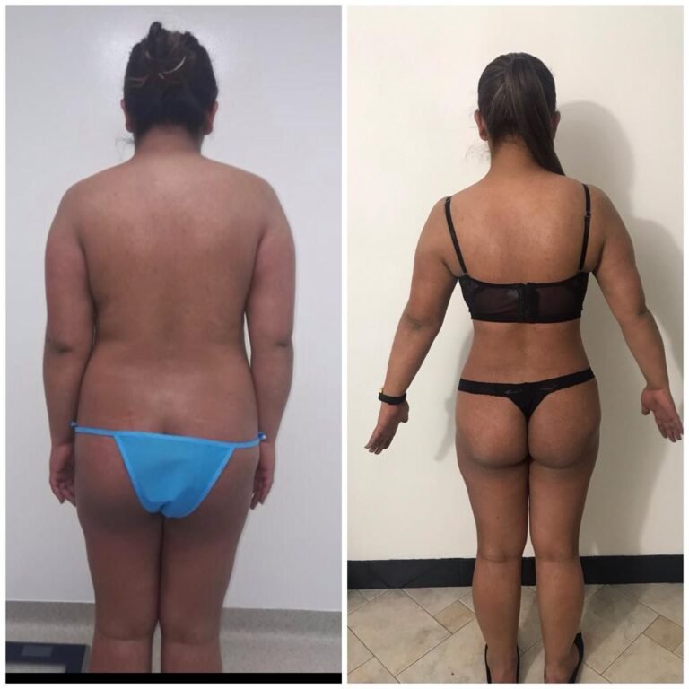 Colcirugia-ColaBBL-07